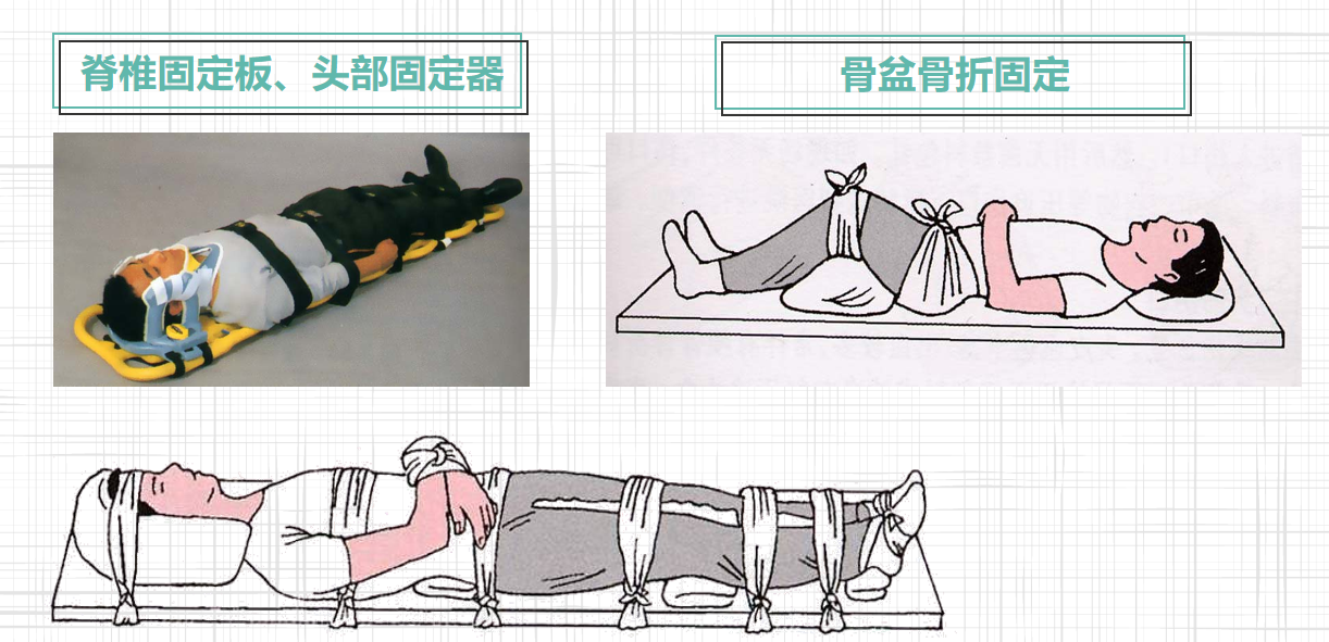 处置方法2